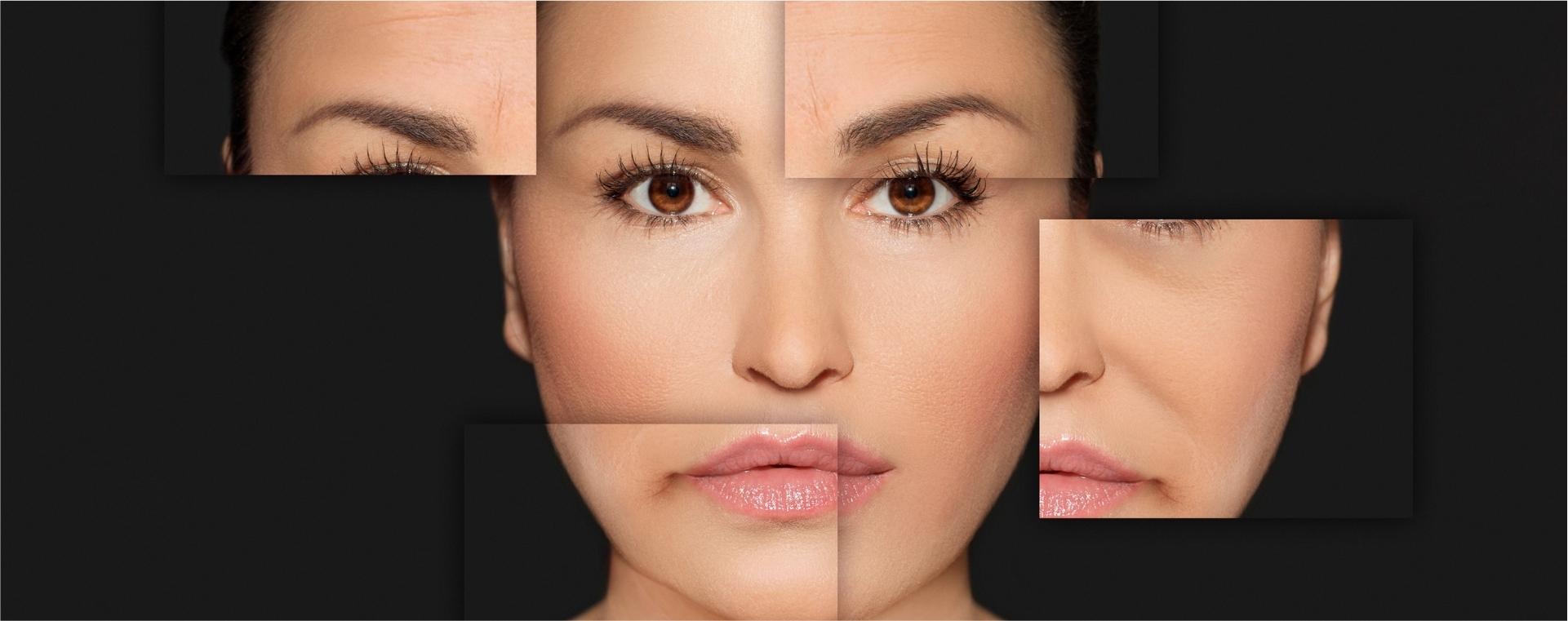 Những ưu điểm của Plasma Fibroblast trong điều trị, làm trẻ hoá da